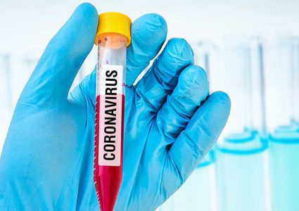 تسجيل أول حالة إصابة بفيروس كورونا في نيجيريا