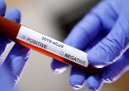 الصحة: 65 مواطنا في الحجر الصحي وفلسطين خالية من "كورونا"