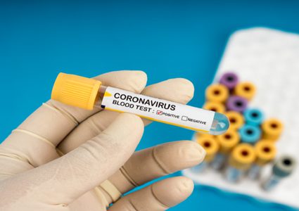 إسباني يتعافى من كورونا باستخدام عقاقير نقص المناعة البشرية