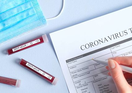 الصحة: 19 إصابة بـ"كورونا" حتى اللحظة و712 عينة غير مصابة