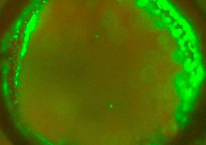 ابتكار مادة حيوية لطبع أوعية دموية بطابعة ثلاثية الأبعاد