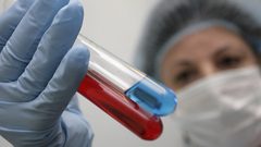 شفاء مصاب بالإيدز للمرة الثانية فقط في التاريخ