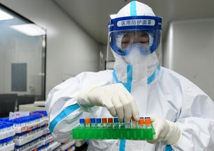 أخصائي فيروسات: انتاج لقاح مضاد فيروس كورونا يحتاج إلى 3 أشهر