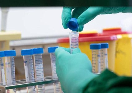 ضبط حالة مشتبه باصابتها بكورونا وتسليمها للجهات المختصة