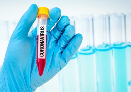 شاهدوا تأثير فيروس كورونا على ظاهرة الاحتباس الحراري في العالم