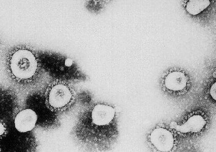 ما المدة الفاصلة بين عدوى كورونا واكتشافها في الفحص؟