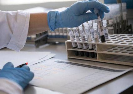 فرنسا تجرب البلازما ضد كورونا