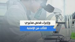 فقدان حاستي التذوق والشم دليل مبكر على الاصابة بكورونا