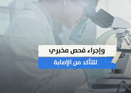 فقدان حاستي التذوق والشم دليل مبكر على الاصابة بكورونا