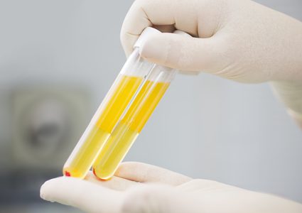 "بلازما النقاهة".. خيار واعد لعلاج مرضى فيروس كورونا