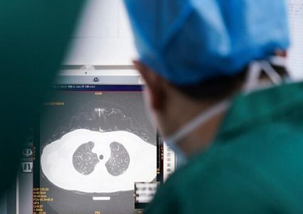 كورونا قد يتلف رئة المصاب حتى دون أعراض!