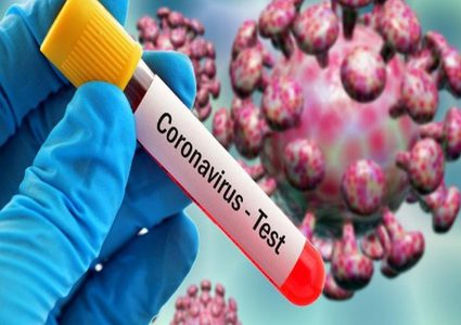 30% من المصابين بفيروس كورونا لا تظهر عليهم الاعراض