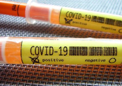 الصحة العالمية: الحرارة العالية لا تحمي من فيروس كورونا