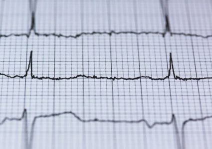 أي جزء من الجسم قد يتألم أثناء النوبة القلبية ؟