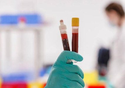 فحوص "الأجسام المضادة" و معركة كورونا