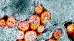 العلماء يكشفون الطريقة الوحيدة للتغلب على كورونا