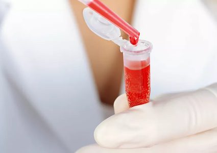 هل نوع فصيلة الدم قد يشير أنك أكثر عرضة للإصابة بكورونا؟