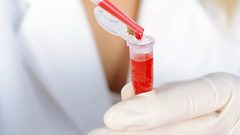 هل نوع فصيلة الدم قد يشير أنك أكثر عرضة للإصابة بكورونا؟