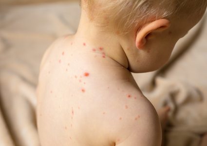 دراسة تكشف شعور الأطفال المصابين بفيروس كوفيد-19