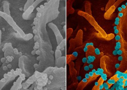 3 دراسات تنفي وجود علاقة بين كورونا وأدوية الضغط