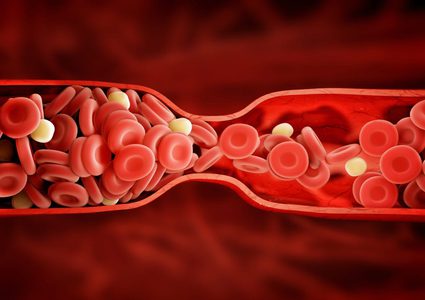دراسة: تخثر الدم يزيد خطر وفاة مرضى فيروس كورونا