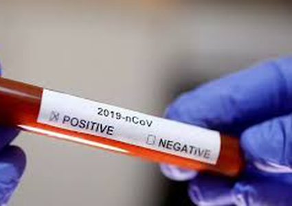 سلوفاكيا: لا إصابات جديدة بفيروس كورونا في البلاد