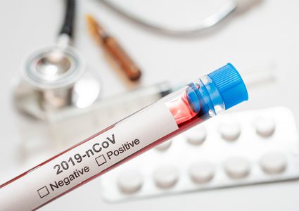 صحة غزة: جرى فحص  216 عينة ولا اصابات جديدة بفيروس"كورونا"