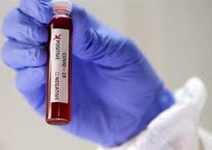 إيران: تسجيل 34حالة وفاة بكورونا و2023 اصابة خلال 24 ساعة الماضية