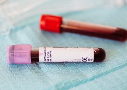 أشخاص محميون من كورونا