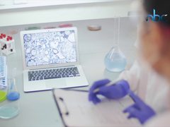 الأشخاص الذين ينتمون لفصيلة الدم( O) هم الأكثر مقاومة لكورونا