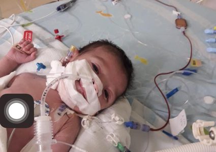 تأجيل عملية قلب لرضيع من غزة أدت الى وفاته