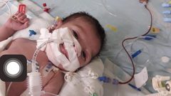 تأجيل عملية قلب لرضيع من غزة أدت الى وفاته