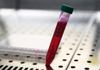 العراق: تخوفات من مرحلة وبائية خطيرة مع تزايد المصابين بكورونا