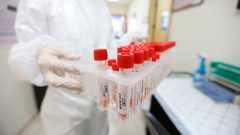 رئيس الجالية الفلسطينية علي الصالح: 30 إصابة بين أبناء الجالية