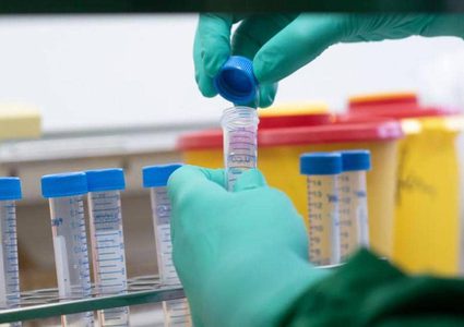 الصحة العالمية تكشف عن تكلفة علاج العالم من كورونا