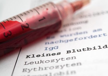 دراسة تؤكد: فحص الدم لا يكشف الإصابة بعدوى كورونا