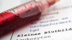 دراسة تؤكد: فحص الدم لا يكشف الإصابة بعدوى كورونا