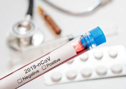 الصحة:حالة وفاة و324 اصابة جديدة بفيروس كورونا