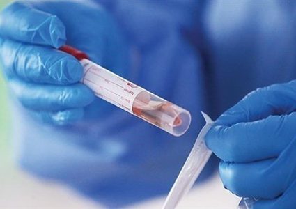 مدير الطب الوقائي بالصحة يتحدث عن سبب تأخر نتائج فحوصات "كورونا"