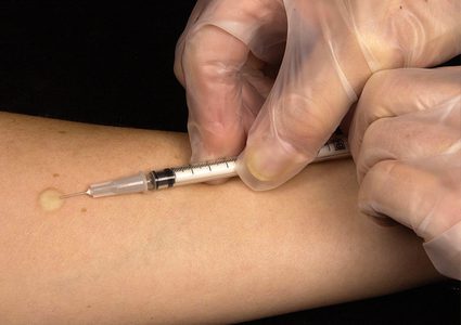 دراسة: لقاح السل يقلل من خطر مضاعفات فيروس كورونا