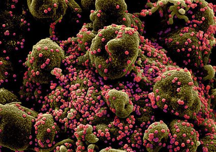 الصحة العالمية تتخوف من تسوء أزمة كورونا "أكثر فأكثر"