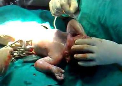 زوجة أسير تُرزق بـطفلة عبر "نطف مهربة"