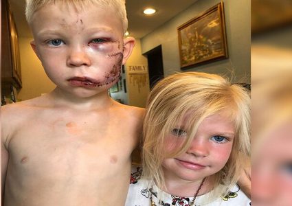 مواقع التواصل تتداول قصة شجاعة طفل أنقذ شقيقته من هجوم كلب شرس