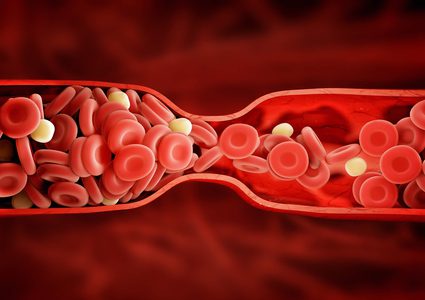 دراسة: "تخثر الدم" عامل رئيسي في زيادة وفيات كورونا