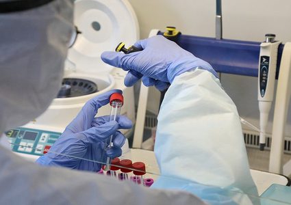 تسجيل ٣٣ اصابة بفيروس كورونا من المخالطين في محافظة قلقيلية