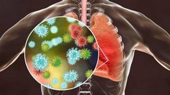 ابتكار دواء جديد يعيد إحياء قدرة الرئتين على مواجهة كورونا