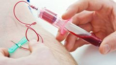 "زهيد الثمن"..تطوير اختبار دم خاص بالكشف عن خطر الإصابة بالسرطان