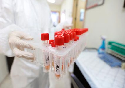 أربع إصابات جديدة بفيروس كورونا في سلفيت