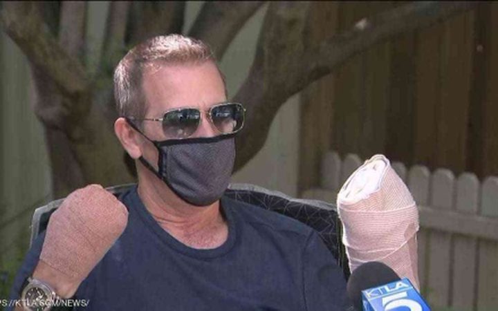 أمريكا.. "المريض صفر"  يروي معاناته مع وباء كورونا