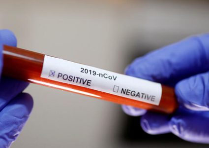 الصحة وهيئة الأسرى تؤكدان إصابة أسير محرر بفيروس كورونا